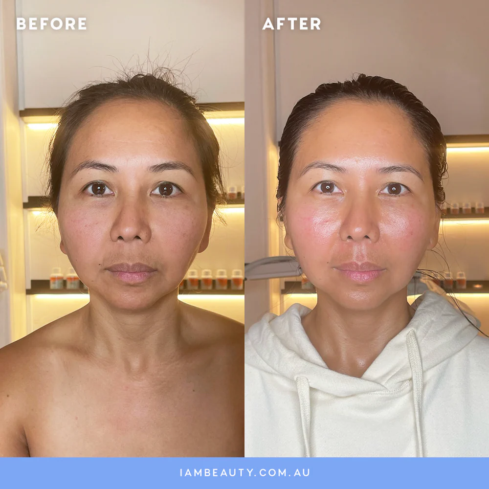 Year-long jade roller transformation side-by-side photos