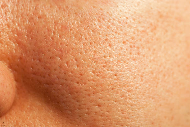 facial pore closeup